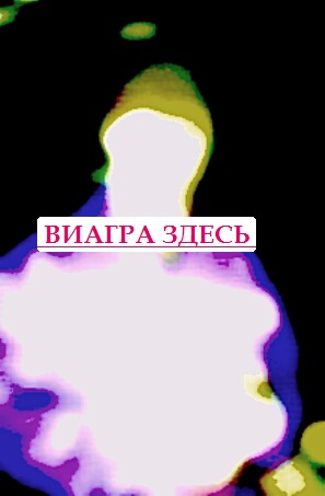 Андриол форум вши окраска волос
