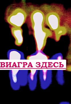 Контрастный душ и потенция где купить дженерики Новочеркасск, 12 см половой член в состоянии эрекции это норма